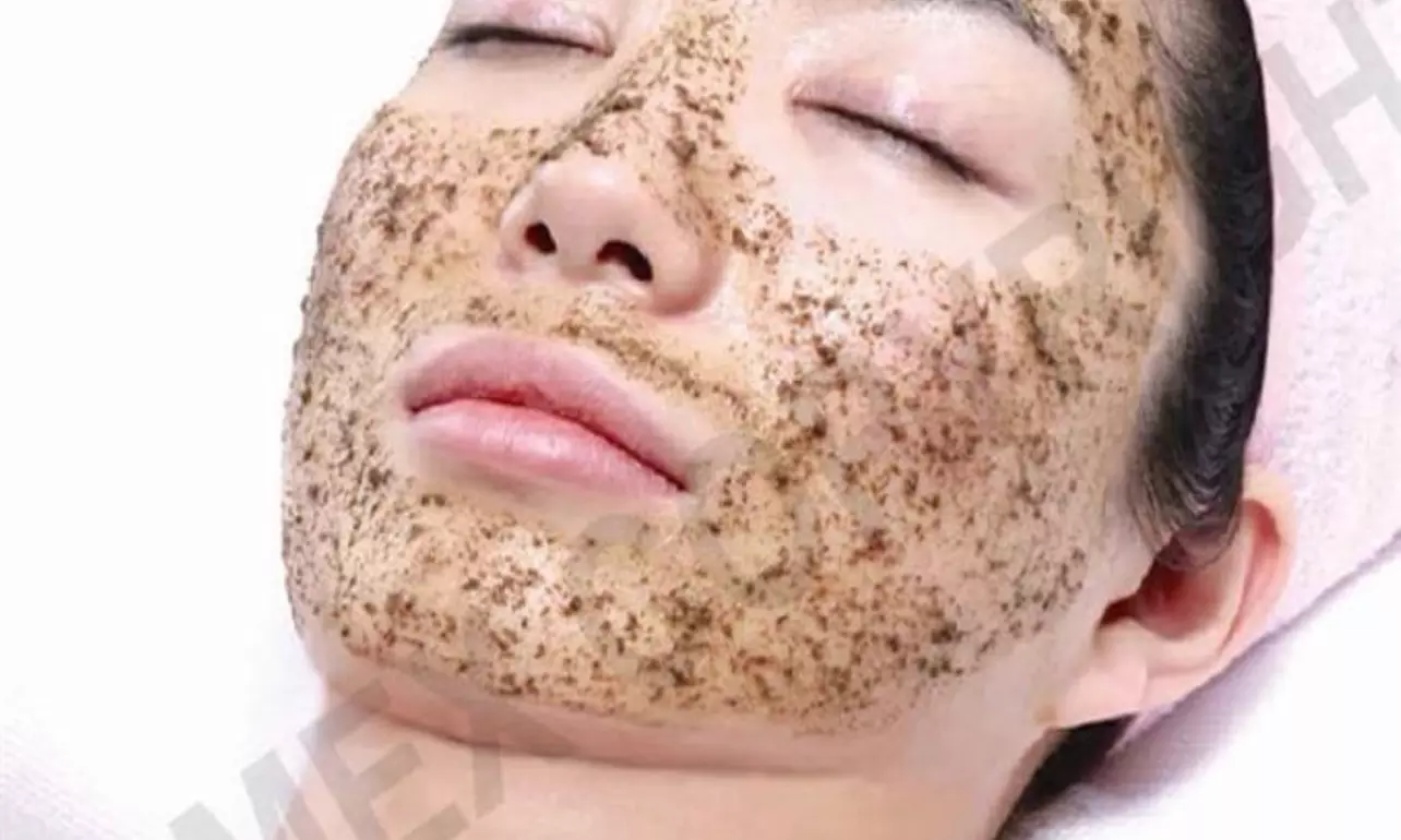 Up to 40% off Liquid Microneedling Treatment at Exotica Skin Care