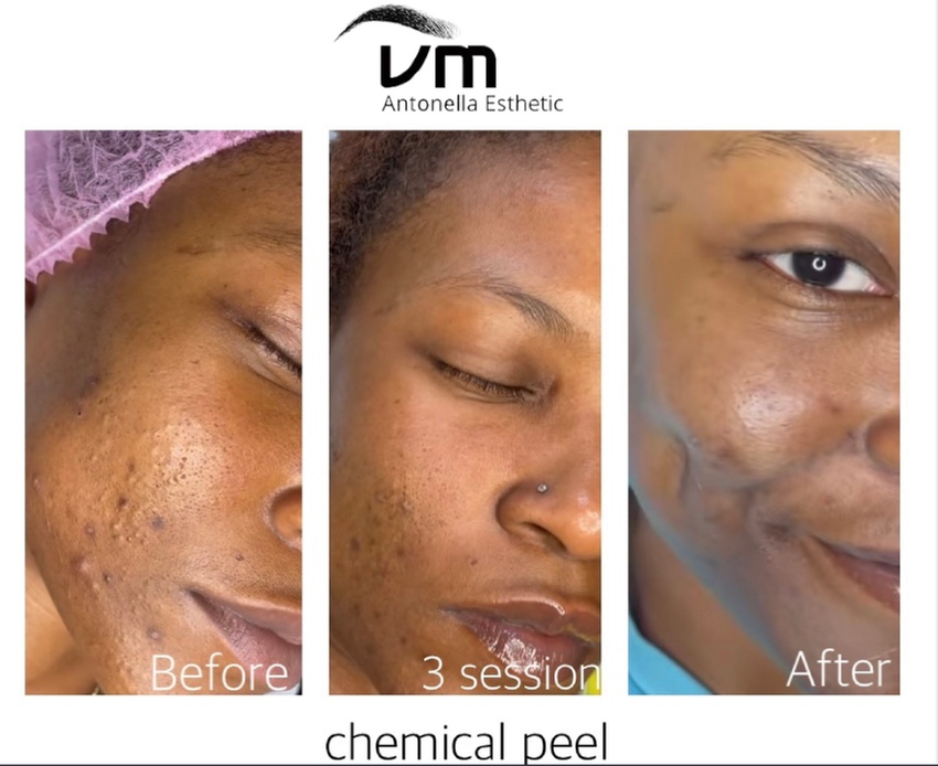 Choice of Facial Treatments in Spa for Radiant Skin