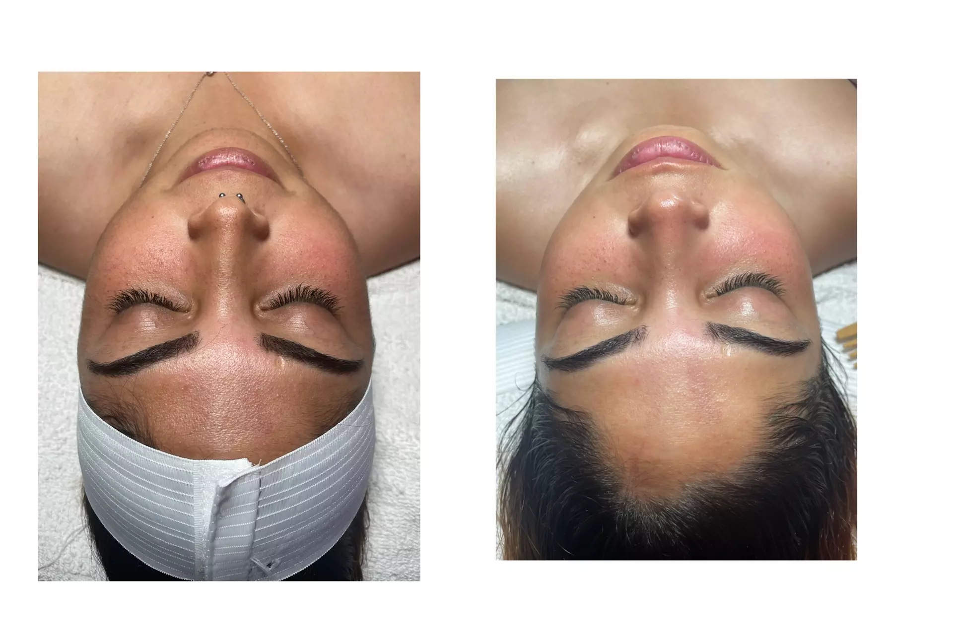 Experience a Facial Choice at Matlali Beauty & Esthetics for Radiant Glow up to 48% Off - Primary Image