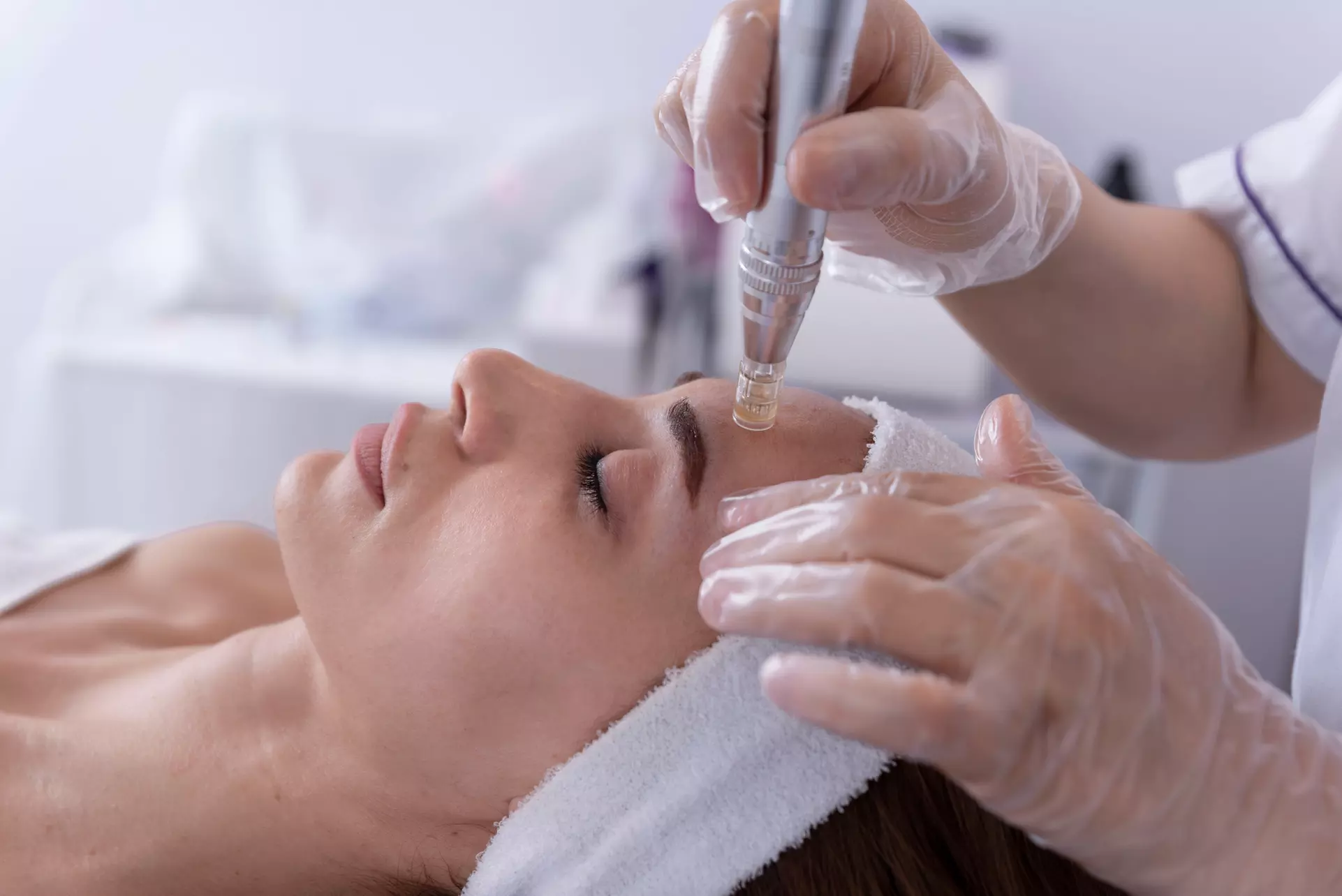 Transform Your Look at Walker Wellness with One Micro-Needling PRP Facial or Scalp (Up to 40%Off) - Primary Image