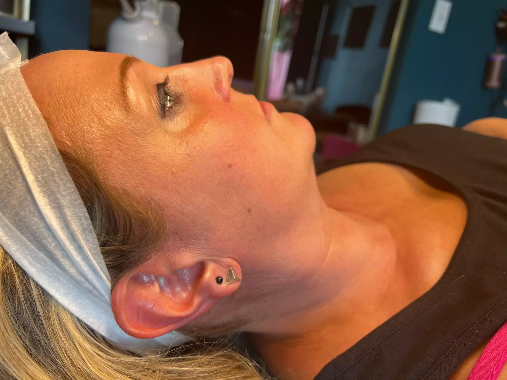 Up to 48% Off on Chemical Peel at The Unlimited Clinic - Primary Image