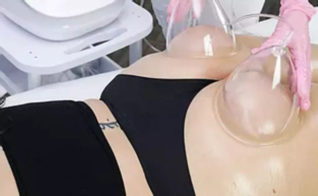 Up to 40% Off on Cupping at GlamSlim Beauty and Fitness LLC - Primary Image
