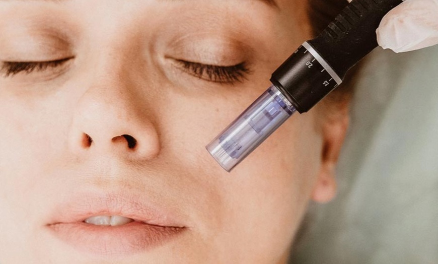 Image 1: Up to 65% Off on  at Shiny Medical Spa & Laser Clinic