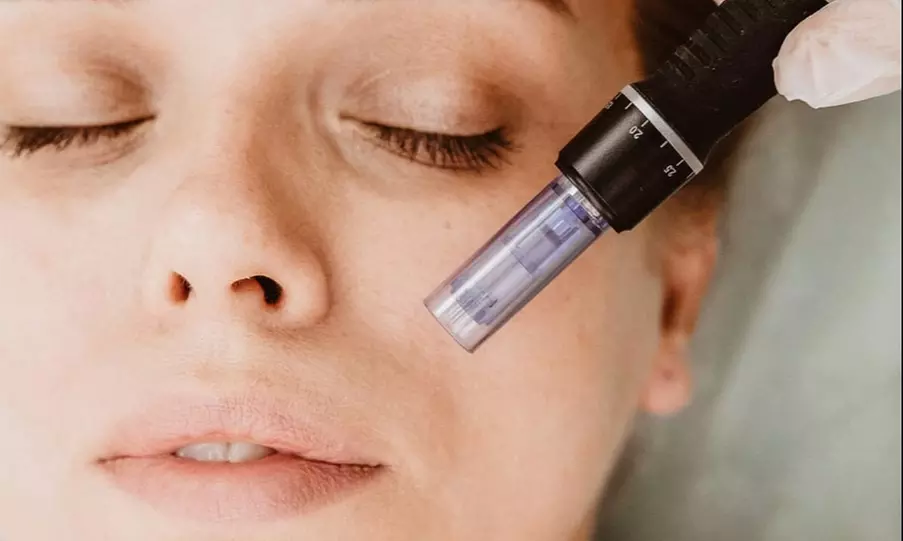 Up to 65% Off on  at Shiny Medical Spa & Laser Clinic - Primary Image