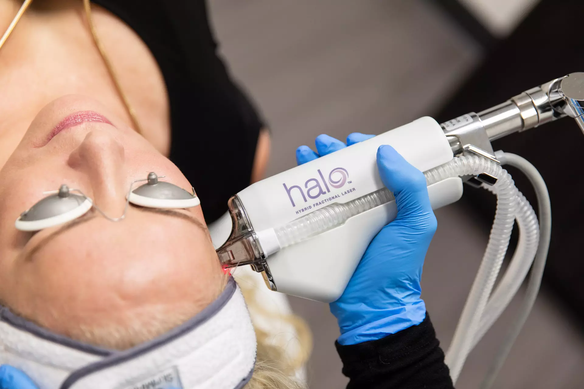Up to 30% Off on Laser Skin Resurfacing at MNML MedSpa - Primary Image