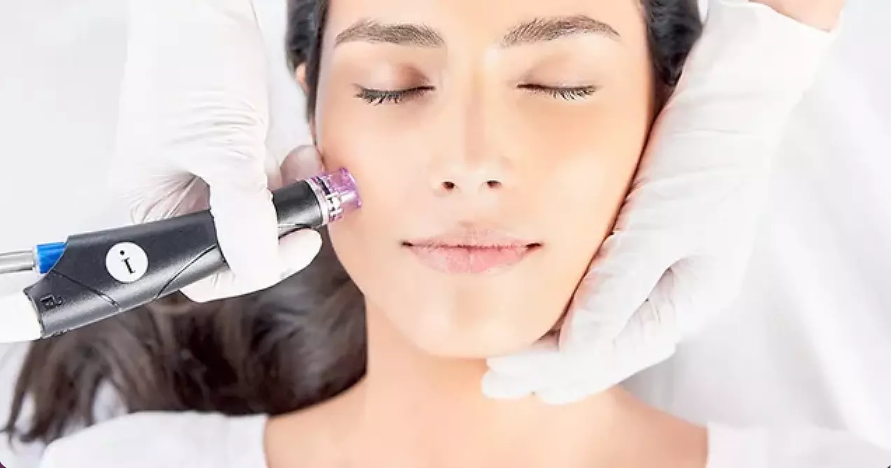 Valentine’s Day Deluxe HydraFacial (Syndeo) at Beauty Bungalow Face & Body Sculpting (use until 2023-03-14)  - Second Medium