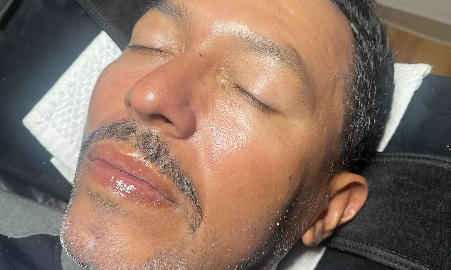 Up to 43% Off on Facial at Valen’s Care