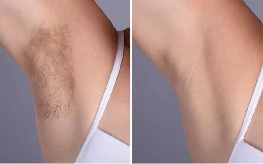 Up to 20% Off on Waxing at Nova Thread Wax & Sugar - Primary Image