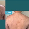Image 3: Laser Hair Removal: Six Treatments for Various Areas