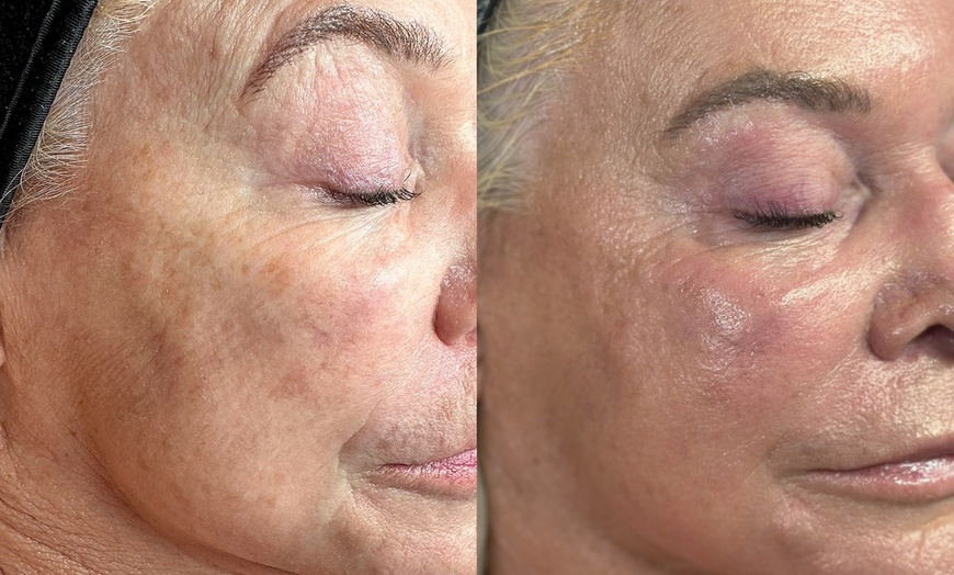 Image 2: Experience 90 Min LED, Peptide Facial or Deep Cleaning Facial!