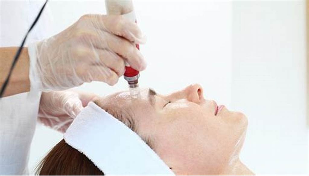 Revitalize Your Skin with Micro-Needling Options