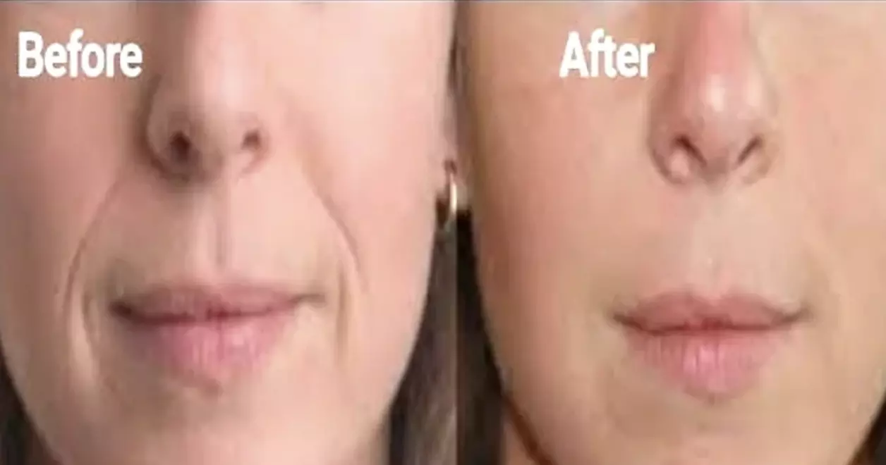 Up to 55% Off on Facial - Anti-Ageing at United Kingdom