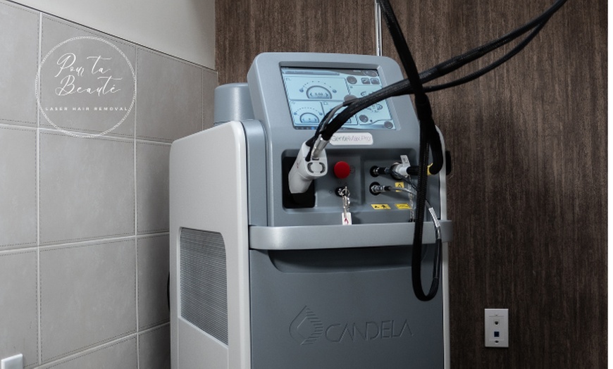 Image 3: Candela GentleMax Pro Laser Hair Removal at Pour Ta Beauté Laser Spa