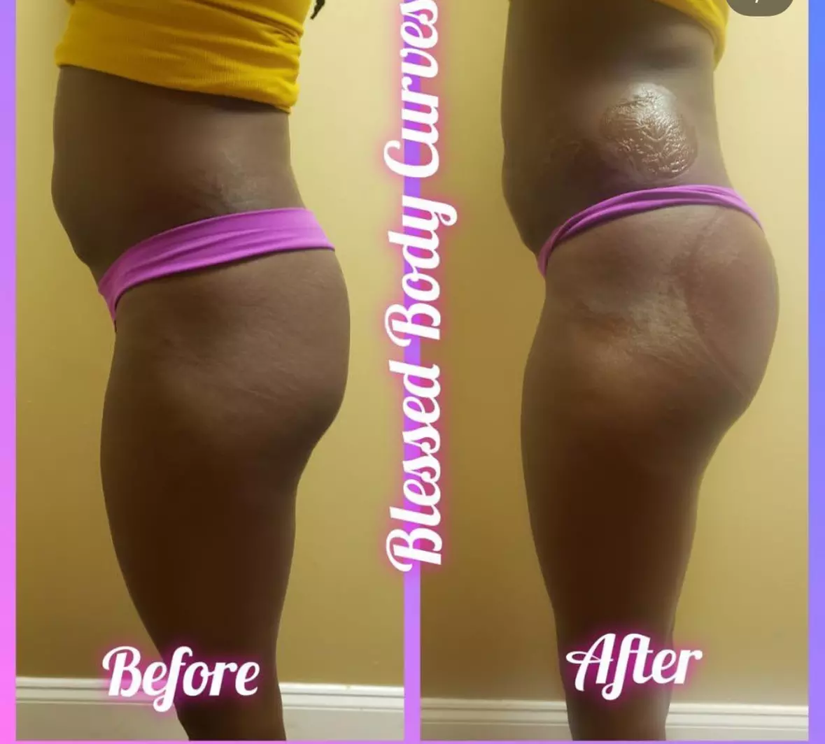 Up to 78% Off on Lipo - Non-Invasive Laser-iLipo at Blessed Body Curves