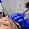 Image 2: Up to 55% Off on Micro-Needling at DivaVida LLC