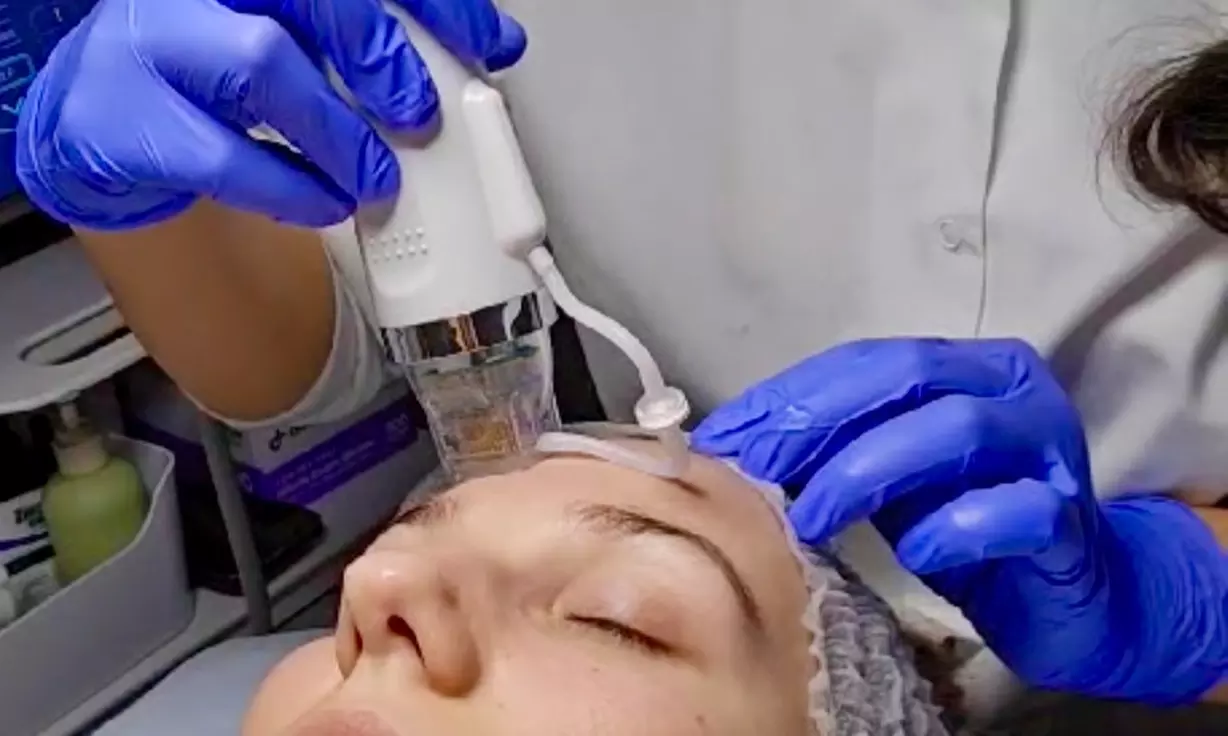 Up to 50% Off on Micro-Needling at DivaVida LLC