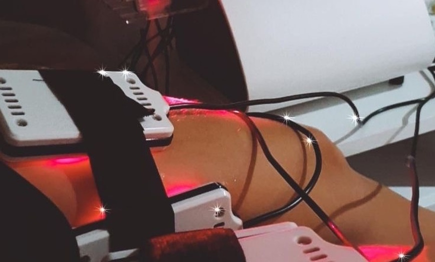 Image 2: Sculpt & Contour with Laser Lipo Treatments