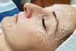 Up to 40% Off on Anti-Aging Facial at Top Skin Solutions - Second Medium