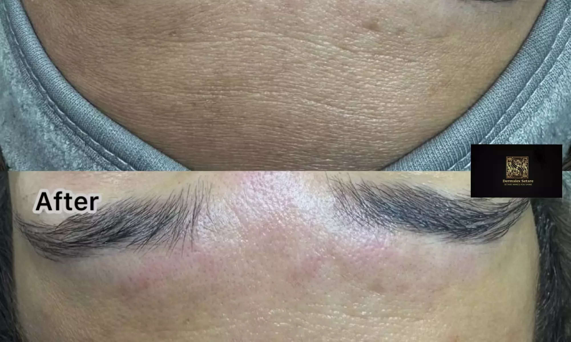 Up to 36% Off on HydraFacial