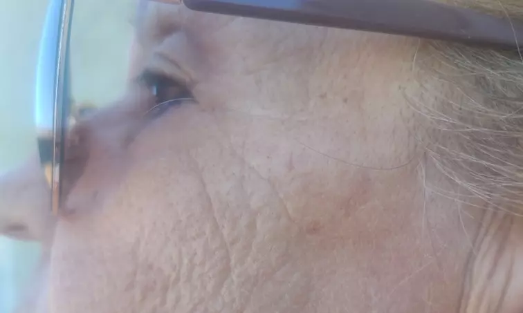 Up to 15% Off on Facelift - Non-Surgical at Luminous Body Sculpting - Second Medium