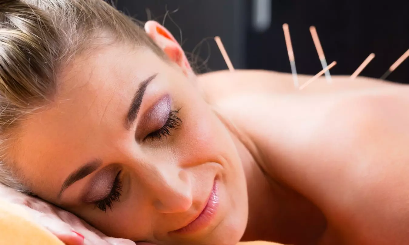 Up to 62% Off on Acupuncture