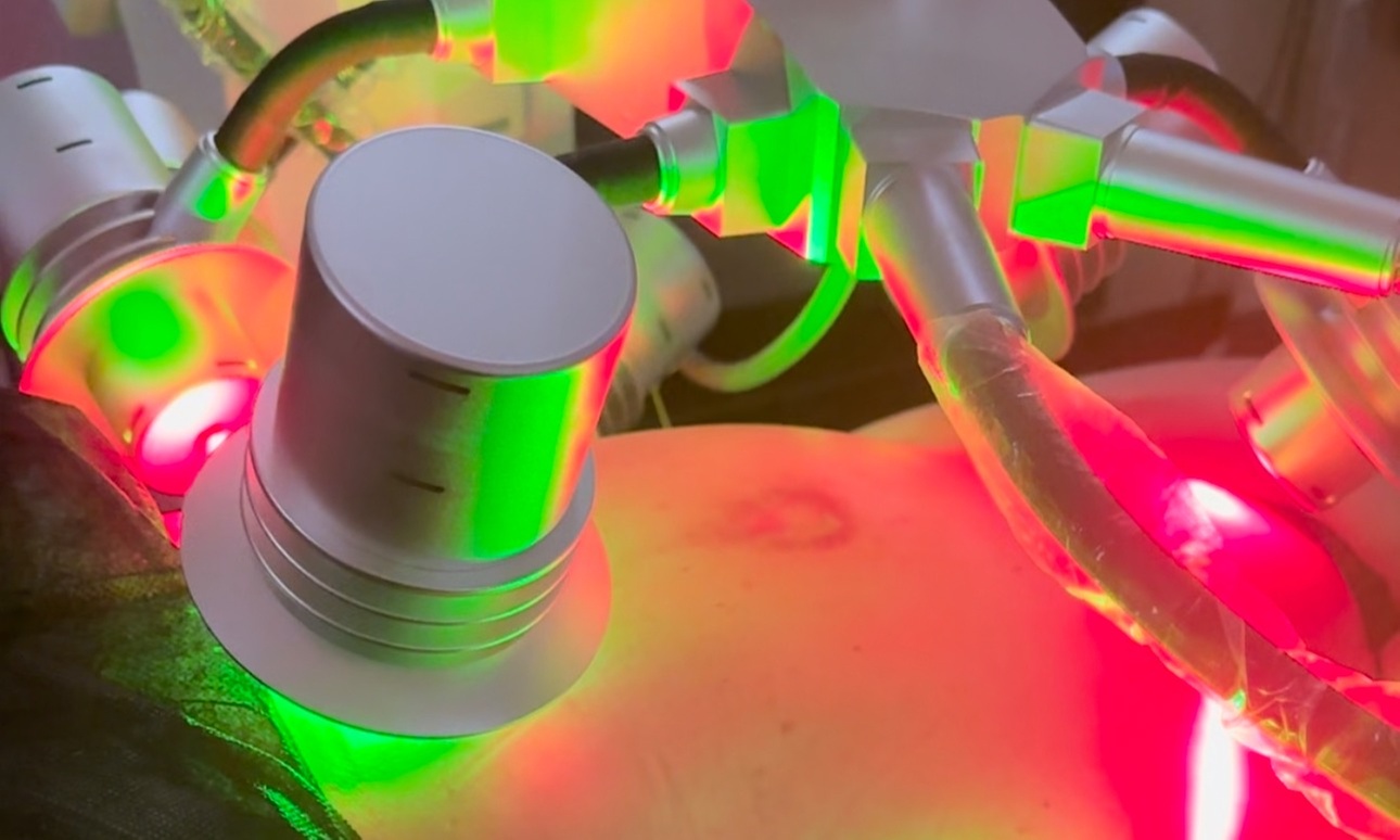 Up to 50% Off on Zerona or Velashape at BodiSnatcher Studio Llc