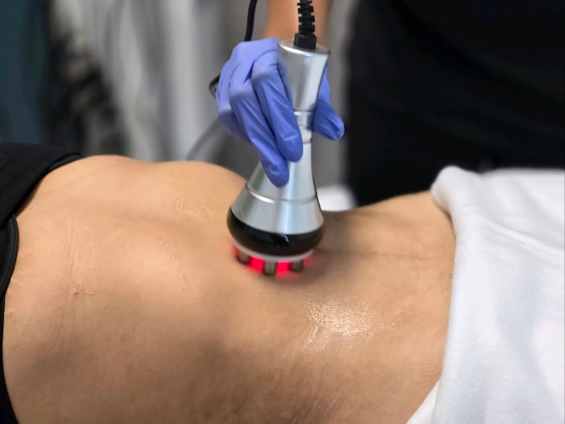 Up to 72% Off on Cavitation at SoFlo Medical Center - Primary Image