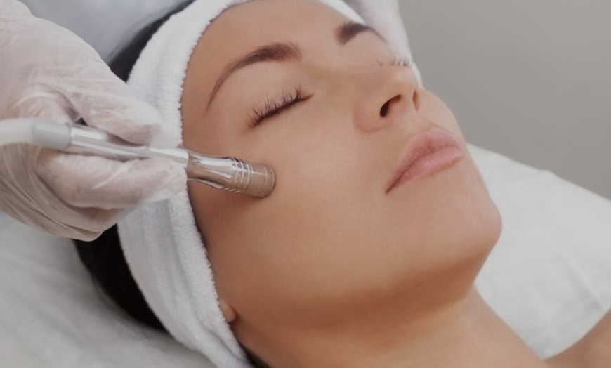 Image 1: Unleash Radiant Skin: Microdermabrasion