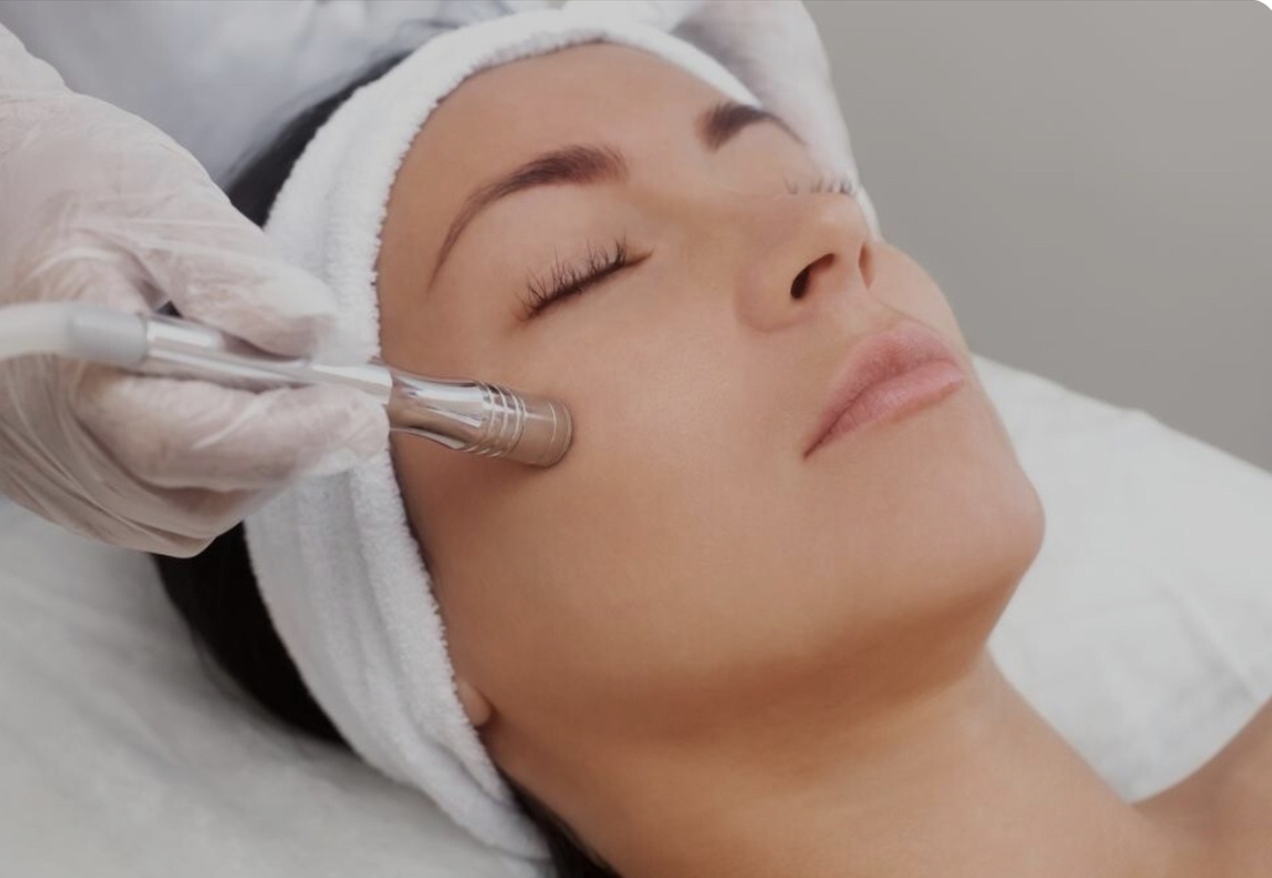 Unleash Radiant Skin: Microdermabrasion