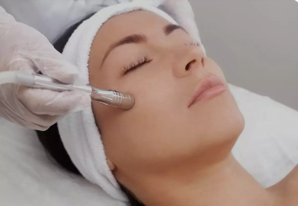Reveal Glowing Skin with One or Two 60-Minute Microdermabrasion at Crownlux (Up to 60% Off) - Primary Image