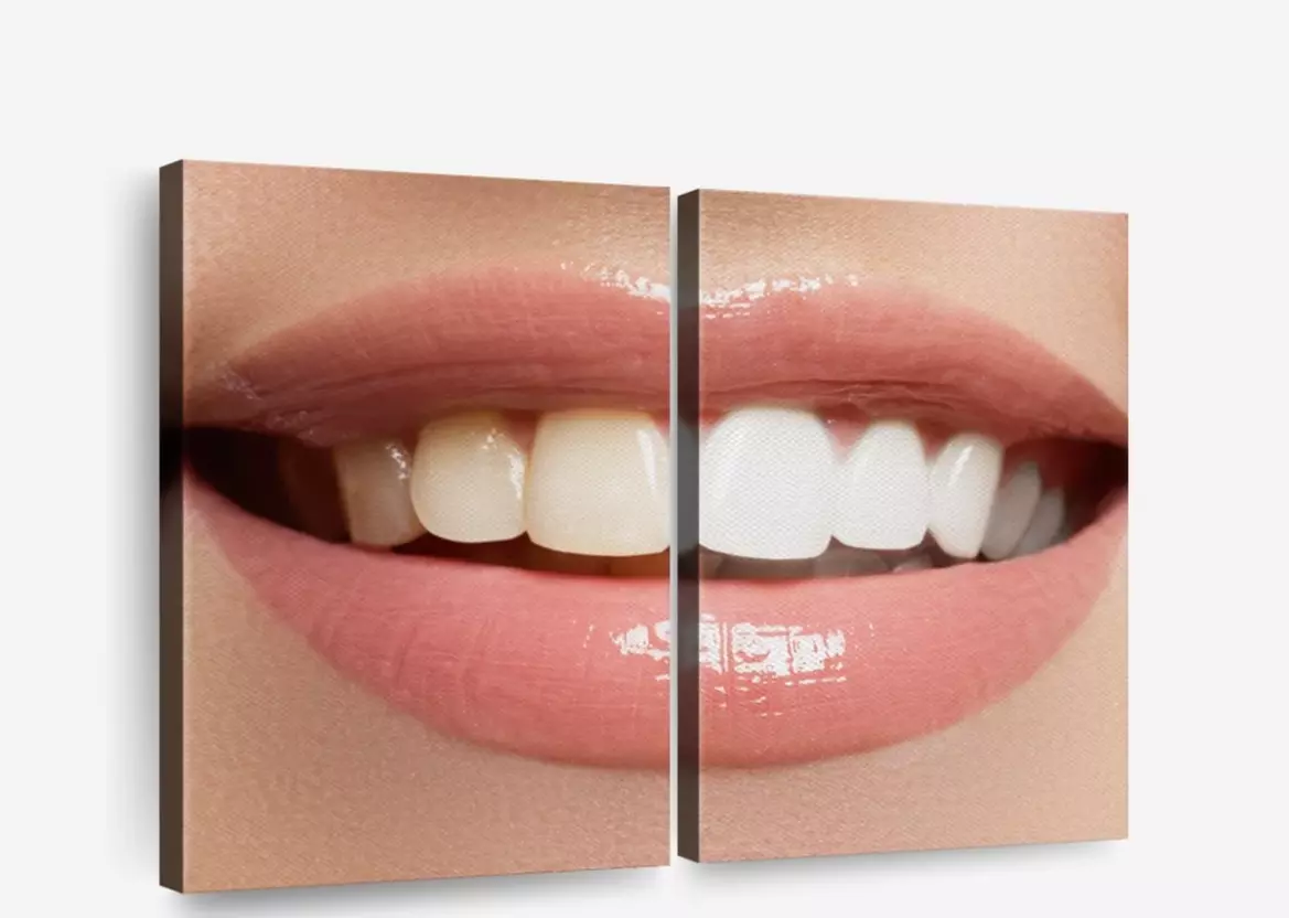 Up to 60% Off on Teeth Whitening at Extreme body sculpting - Primary Image