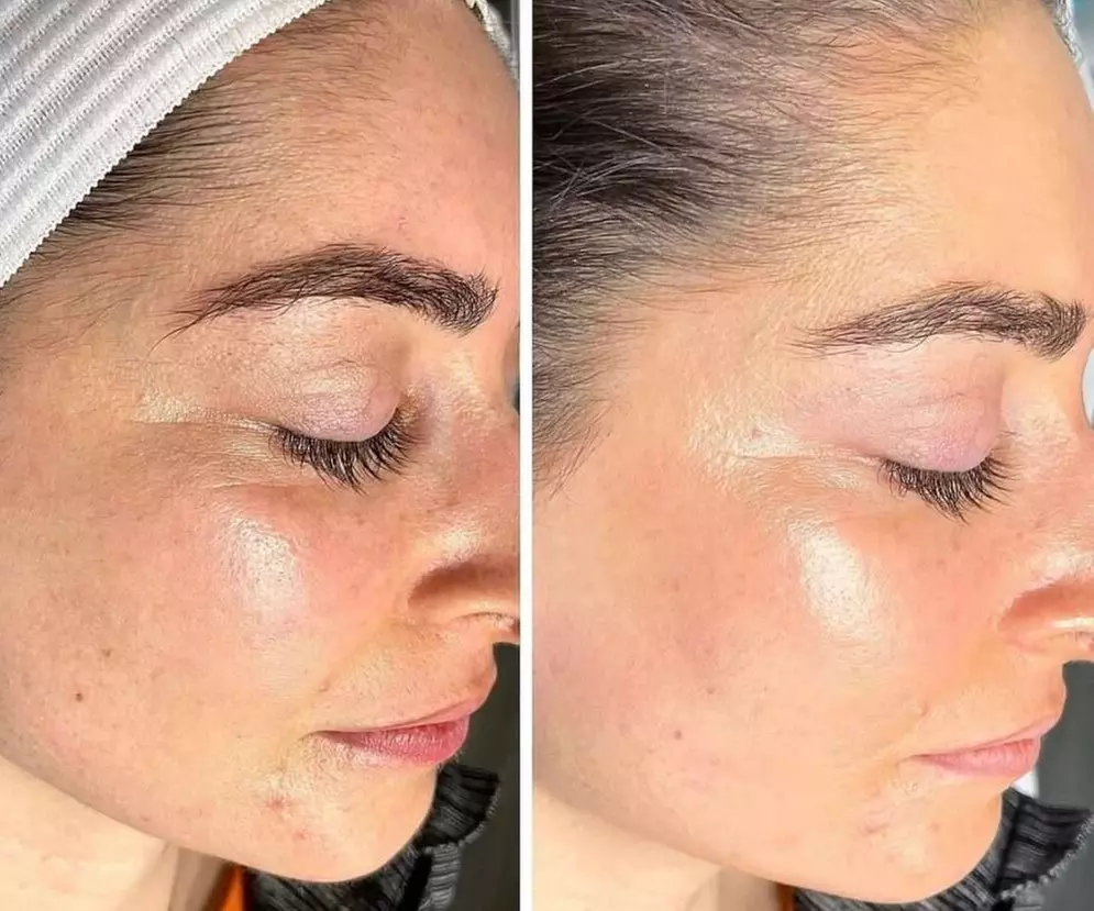 Experience the Ultimate Refresh at Bb Lash Studios 23: Enjoy a Mini HydraFacial! (Up to 35% Off) - Primary Image