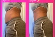 Up to 60% Off on Non-Surgical Butt Lift at Snatched By Queen - Second Medium