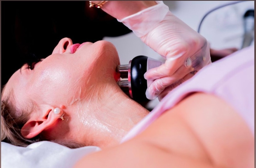 Up to 49% Off on Radio Frequency Skin Tightening at Skin 2 Deep