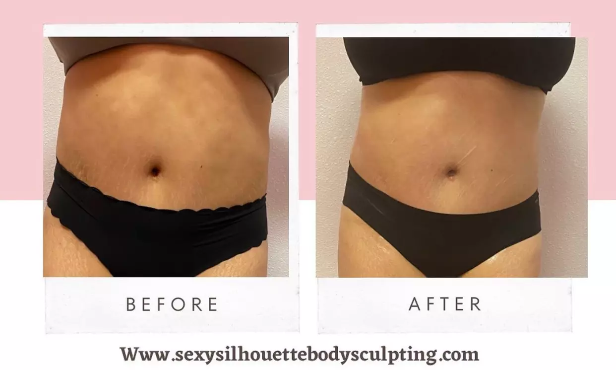 Up to 55% Off on Cavitation at Sexy silhouette by Mari Lu - Primary Image