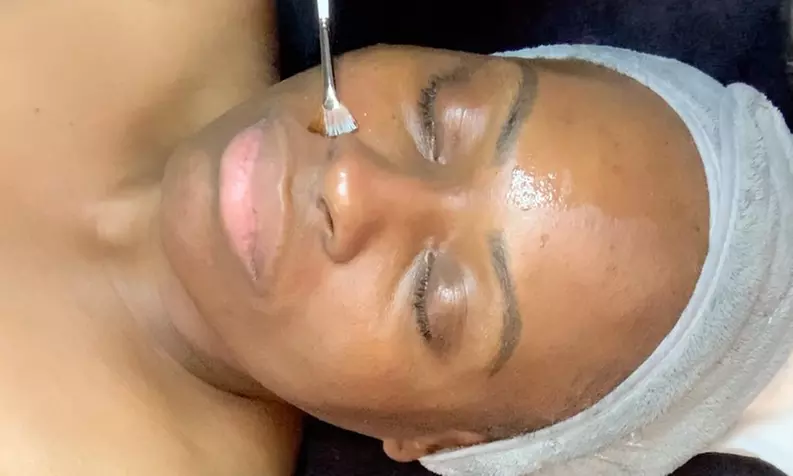 Up to 45% Off on Facial at Vitality Medical Aesthetics, LLC - Second Medium