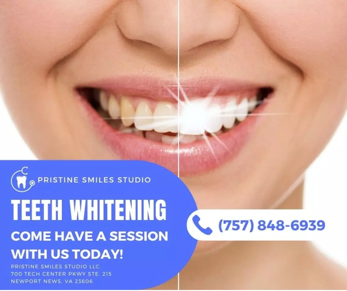 Up to 60% Off on Teeth Whitening at Pristine Smiles Studio - Primary Image