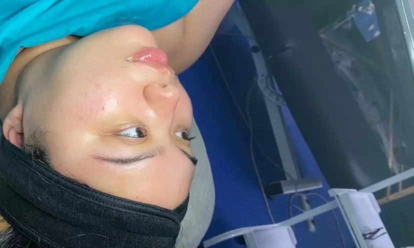 Up to 53% Off on Facial at Fixmyeyezonyou - Primary Image