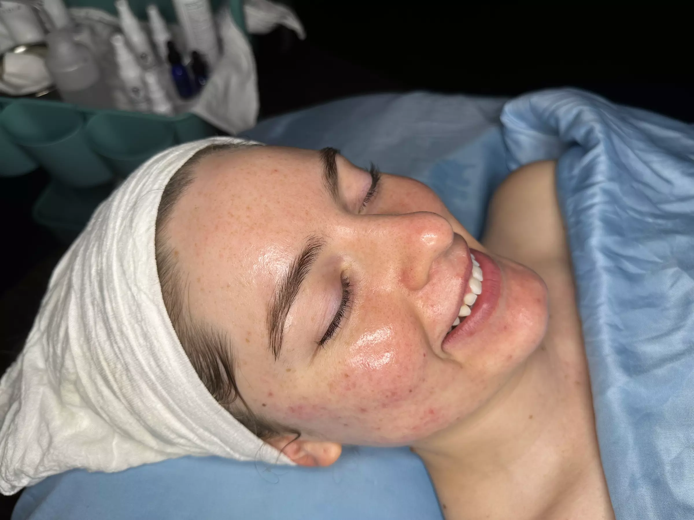Up to 35% Off on Facial - Chosen by Customer at esthetically kweening - Second Medium