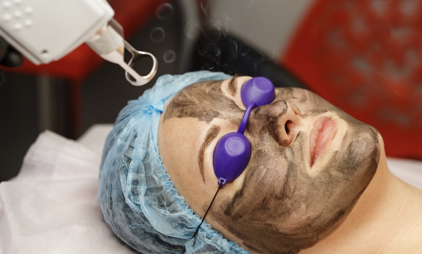 Image 2: 60 or 90-Minute Full Face PICO Carbon Laser Peel w/ Ultrasonic & More