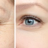 Image 4: Refresh with 20 or 40 Units of Botox