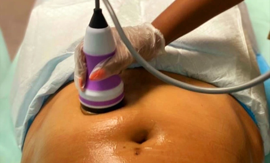 Image 1: Up to 51% Off on Ultrasonic Fat Reduction 