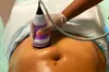 Up to 51% Off on Ultrasonic Fat Reduction at Lastyles Tighten Beauty Bar LLC