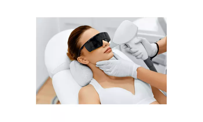 Up to 73% Off on Laser Hair Removal at Ippo Daro Med Spa - Second Medium