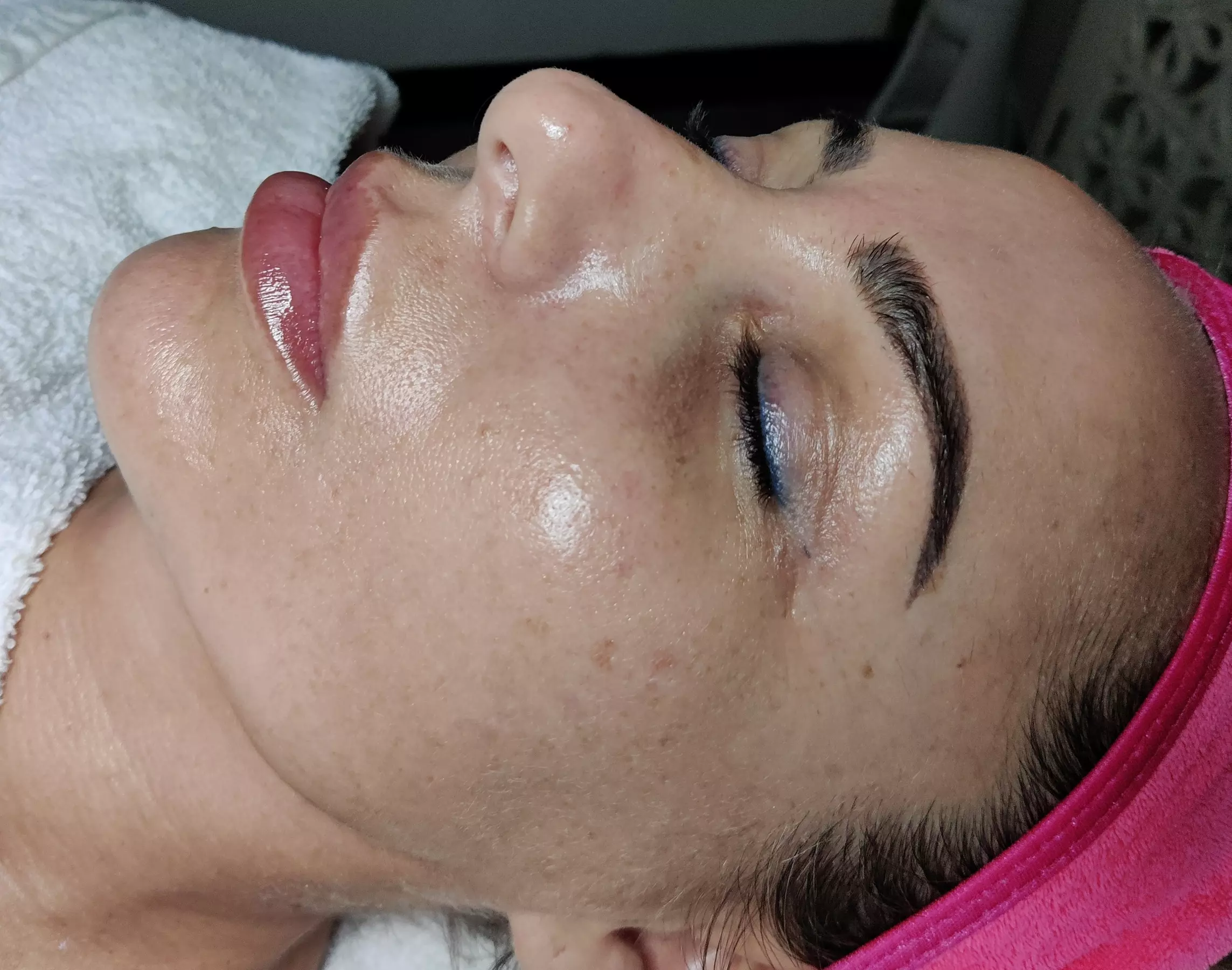 Experience the Ultimate Hydrafacial Package for Radiant Skin