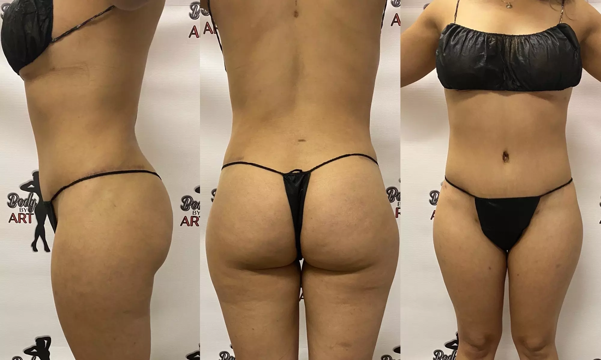 Up to 46% Off on Body Sculpting at BODY BY ART