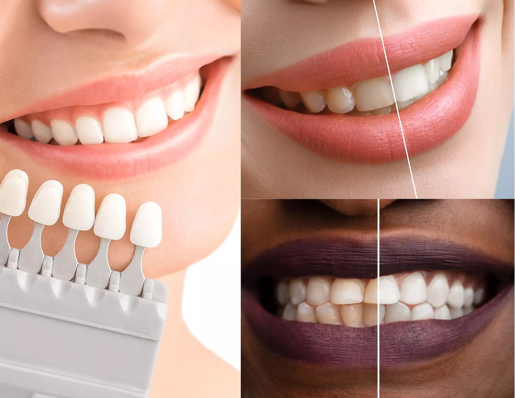 Up to 15% Off on Teeth Whitening - In-Office - Branded (Zoom, Brite Smile) at Rize Brow Studio - Primary Image
