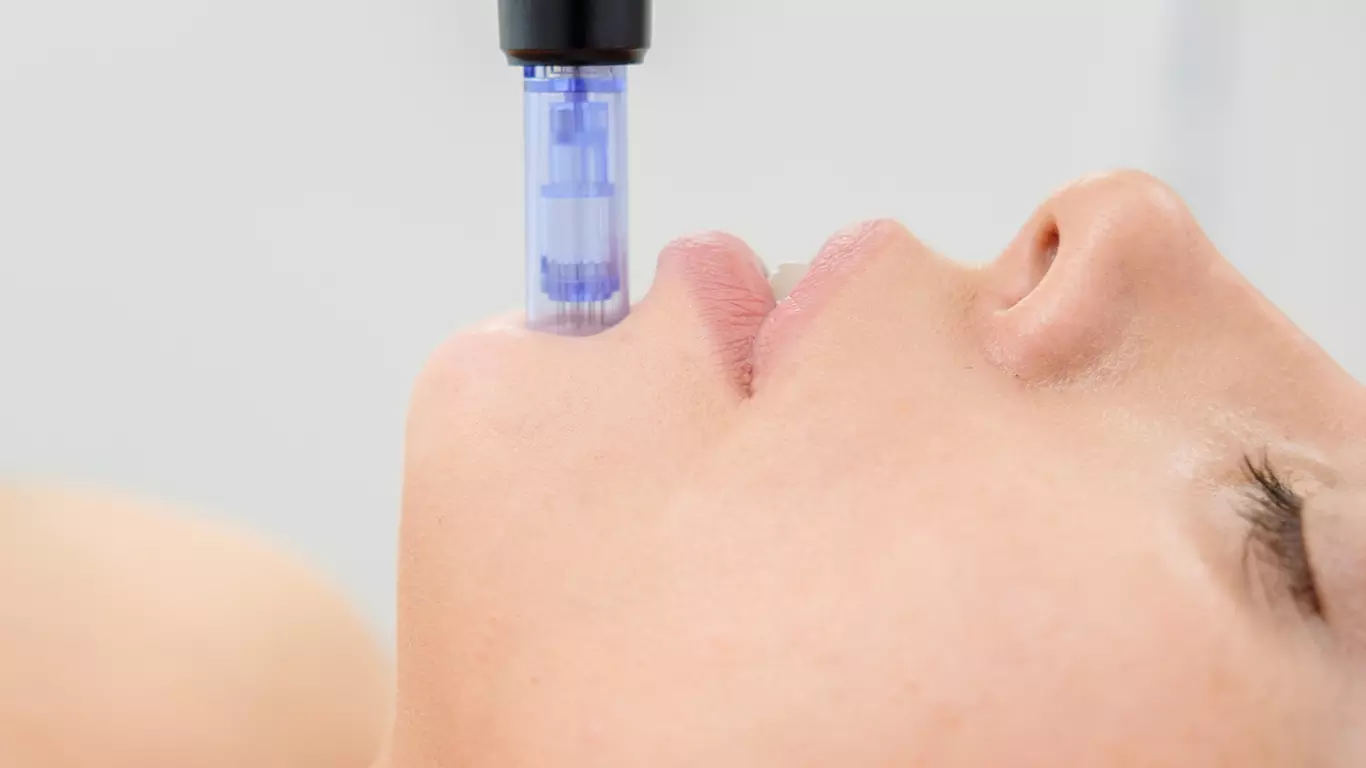 Up to 50% Off on Micro-Needling at Modrn Sanctuary Philadelphia - Primary Image