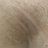 Image 3: Up to 30% Off on Waxing - Underarm at Skin Fusion