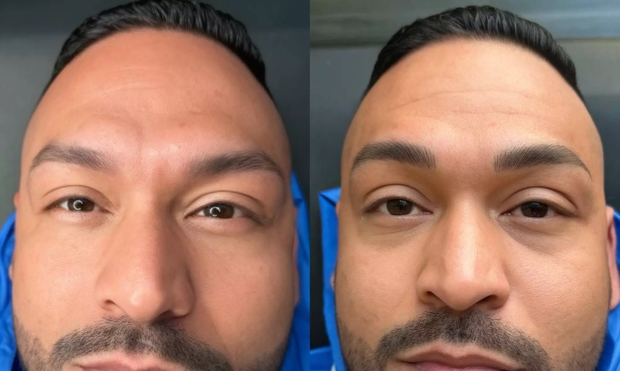 Up to 30% Off on Nano Eyebrow Tattoo Session at Cara Cara Cosmetic Tattoo - Second Medium